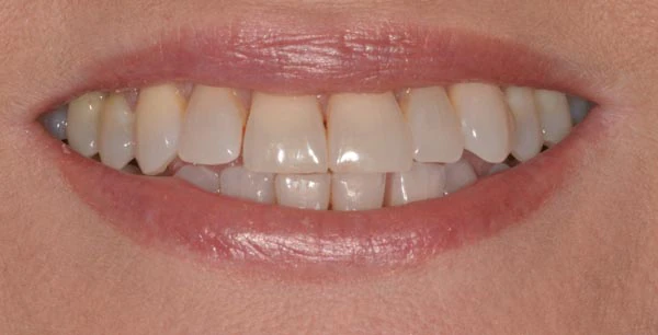 Before image