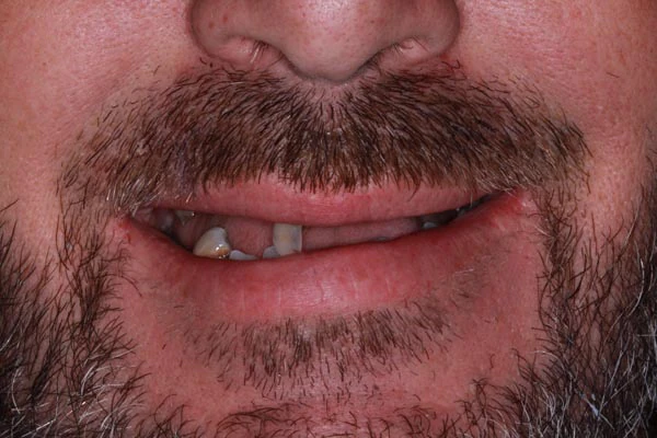 Before image