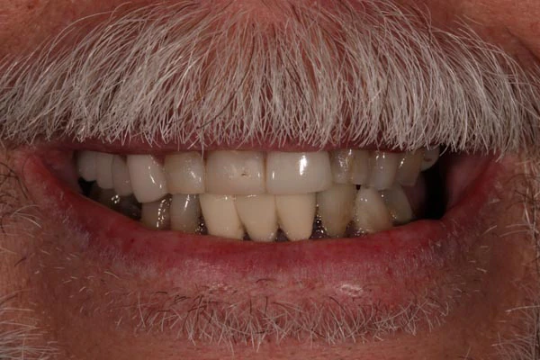 Before image