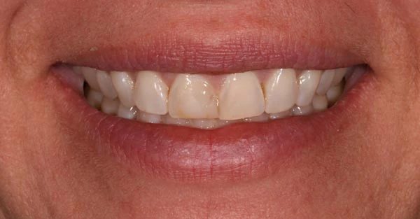 Before image