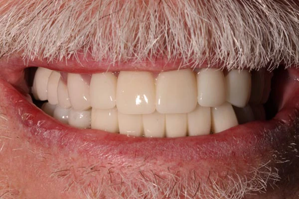 After image
