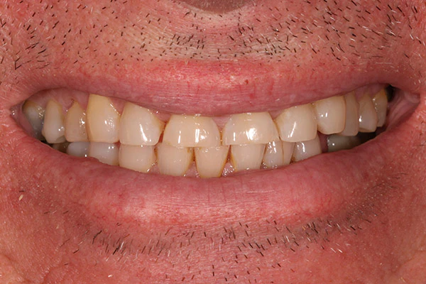 Before image
